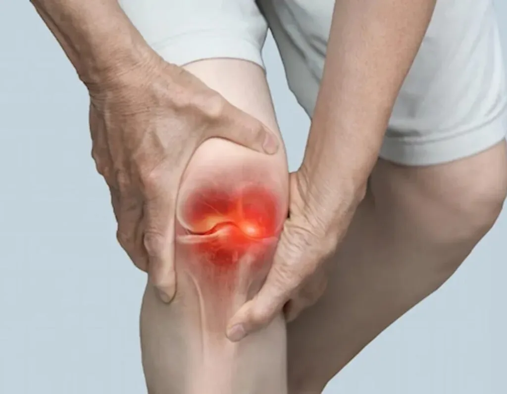 Knee Osteoarthritis