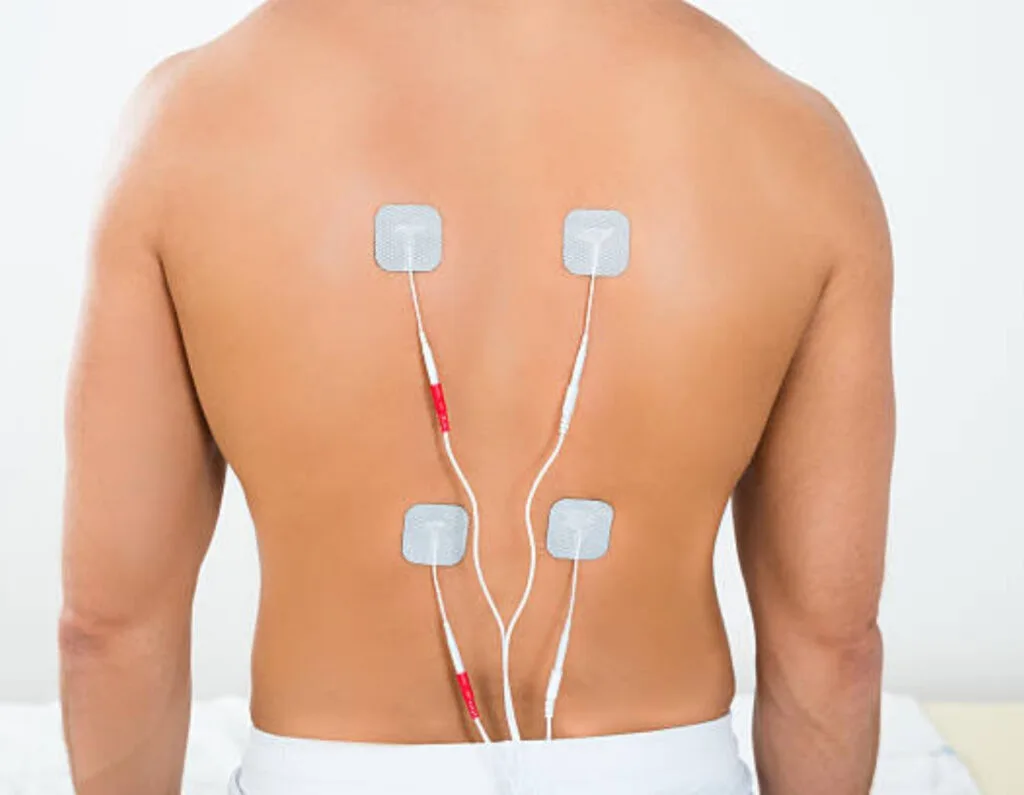 Spinal Cord Stimulation pain management technique