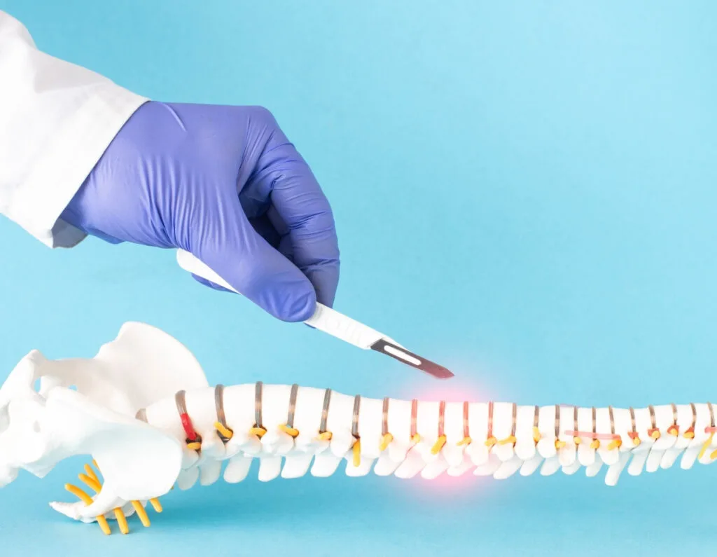 Vertebroplasty procedure